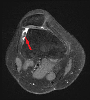 Freier GK MRT — Kniespezialist Wien. Dr. Mark Schurz